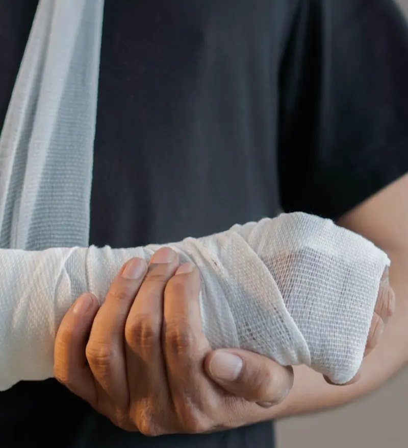 Person wearing a black shirt holding an arm wrapped in white gauze bandage and supported by a sling.